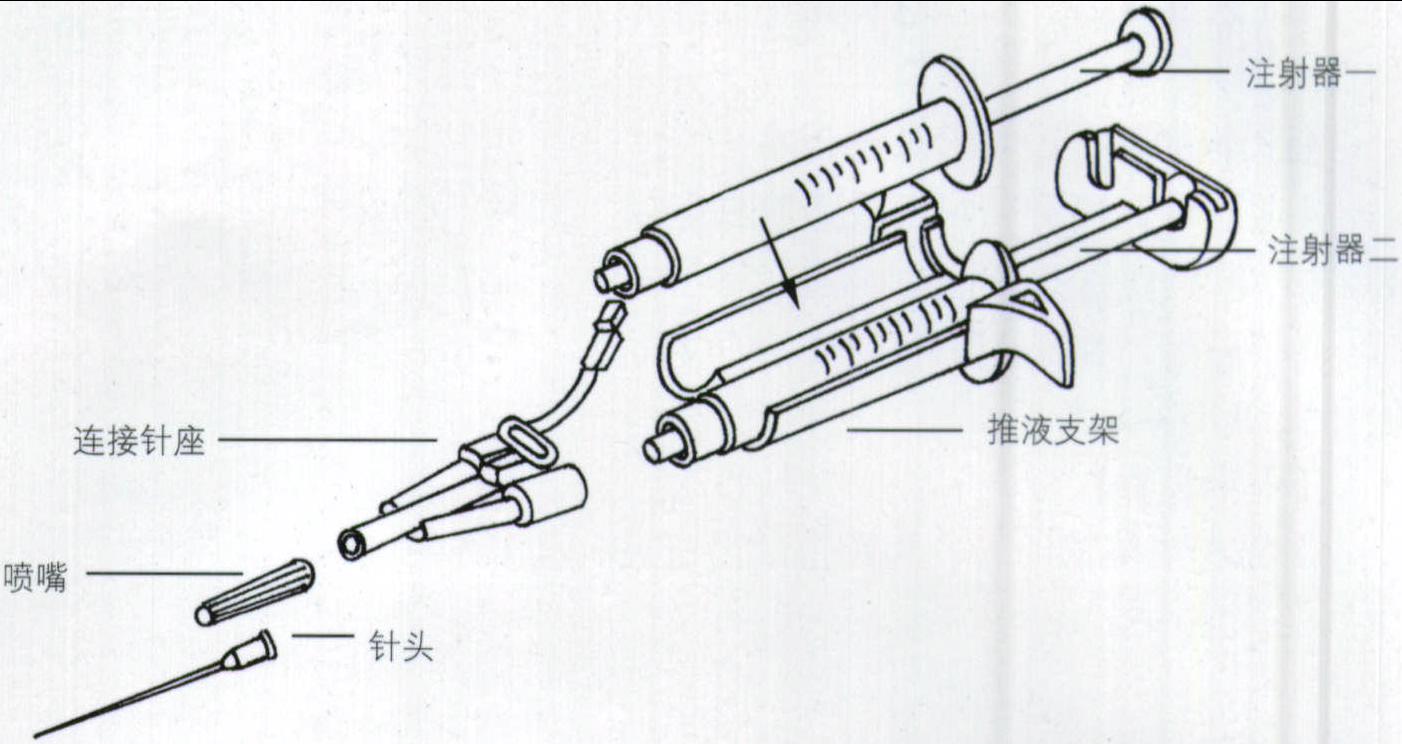 三、輸卵管妊娠行保守性手術(shù)時之復(fù)通術(shù)